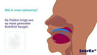 Oplossing tegen snurken [upl. by Eilime]