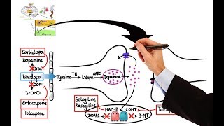 Lesser Known Symptoms of Parkinsons Disease [upl. by Irollam]