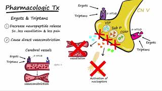 What is Migraine Disease [upl. by Potts]