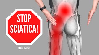 How to Relieve Sciatica Pain in SECONDS [upl. by Llewop]