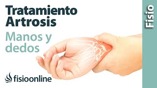 Tratamiento de fisioterapia para la artrosis de manos y dedos [upl. by Carthy91]