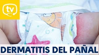 Soluciones para tratar la dermatitis del pañal [upl. by Airehs]